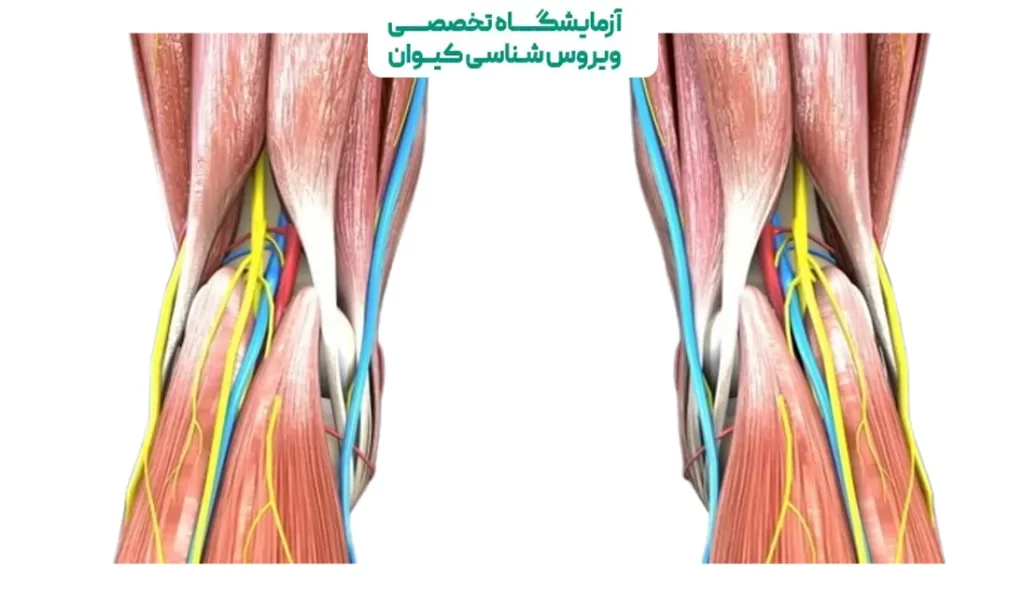 گرفتگی رگ پشت زانو