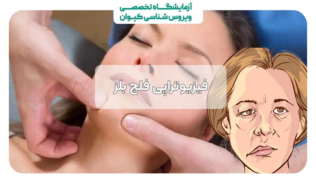 فیزیوتراپی فلج بلز