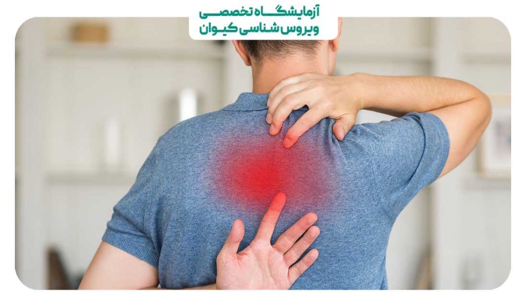سوزش بین دو کتف