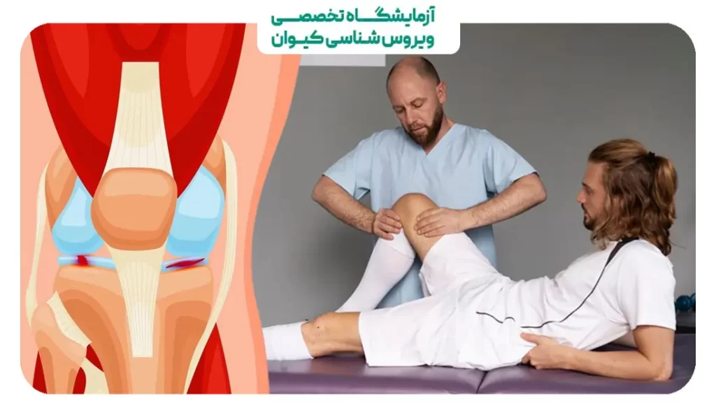 فیزیوتراپی برای زانو درد